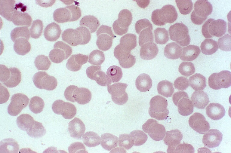 Free picture: parasites, may, mature, erythrocytic, schizont, gametocytes