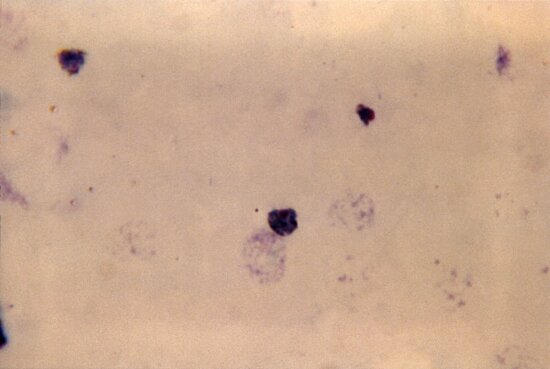 Free Picture Thick Film Micrograph Plasmodium Vivax Gametocyte