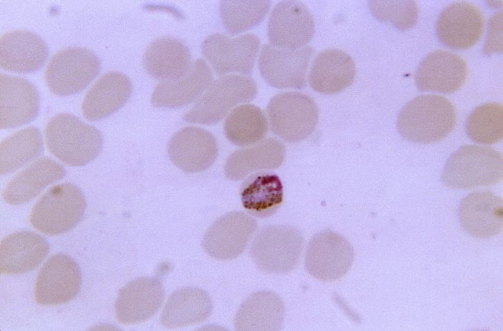 thin, film, blood smear, micrograph, mature, band, form, plasmodium malariae, trophozoite