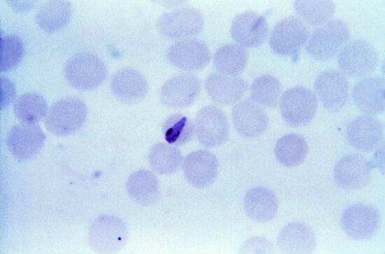thin, film, micrograph, young, growing, plasmodium malariae, banded, trophozoite
