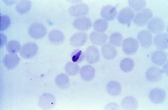 delgada, película, micrografía, joven, cada vez mayor, Plasmodium malariae, bandas, trophozoite