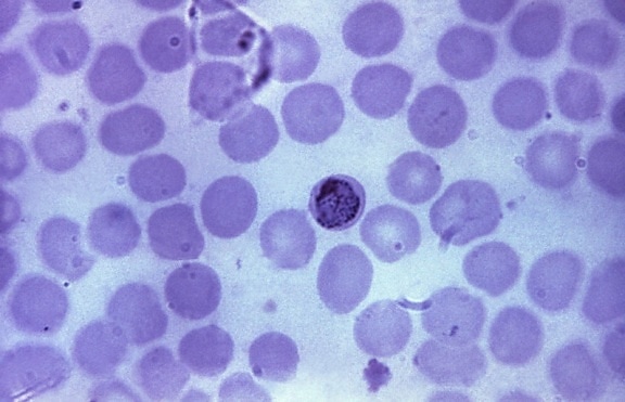 tynn, film, mikroskop-bilde, eldre vokser, plasmodium malariae, trophozoite