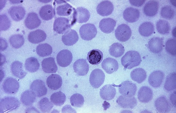 薄膜、顕微鏡写真、古い成長し、四日熱マラリア原虫、トロフォゾイト