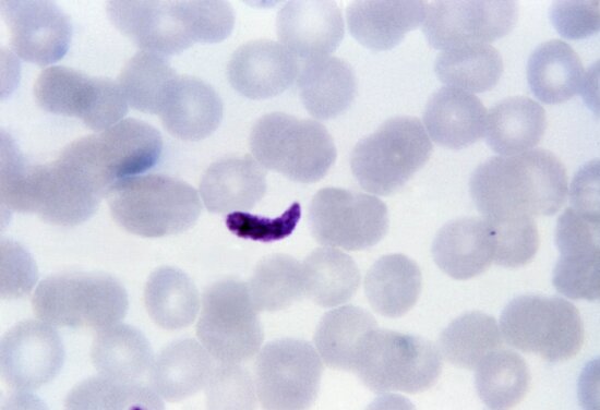 thin, film, micrograph, fused, platelets, resemble, plasmodium gametocyte
