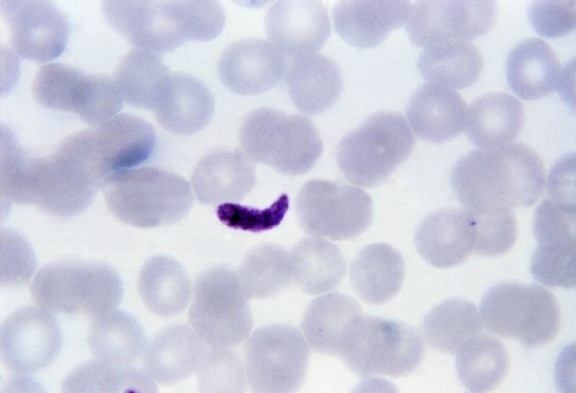 tenká, film, mikrofotografie, tavený, trombocyty, vypadat, plasmodium gametocyte