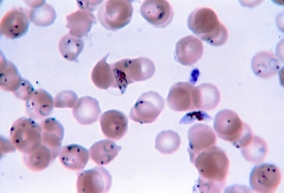 tynn, film, mikroskop-bilde, ring, skjemaer, gametocytes, plasmodium falciparum