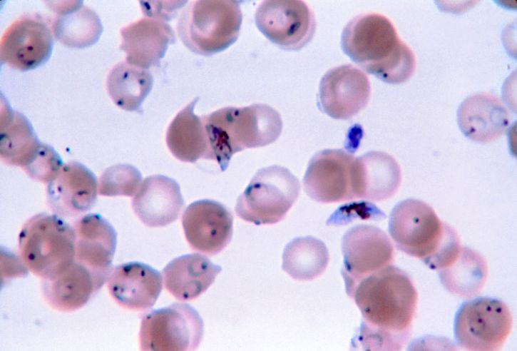 얇은, 영화, 현미경 사진, 반지, 형태, gametocytes, 변형 체 falciparum