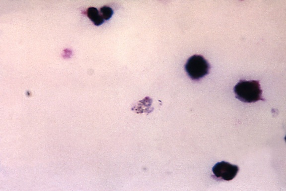 frotis de sangre, micrografía, Plasmodium vivax, trophozoite