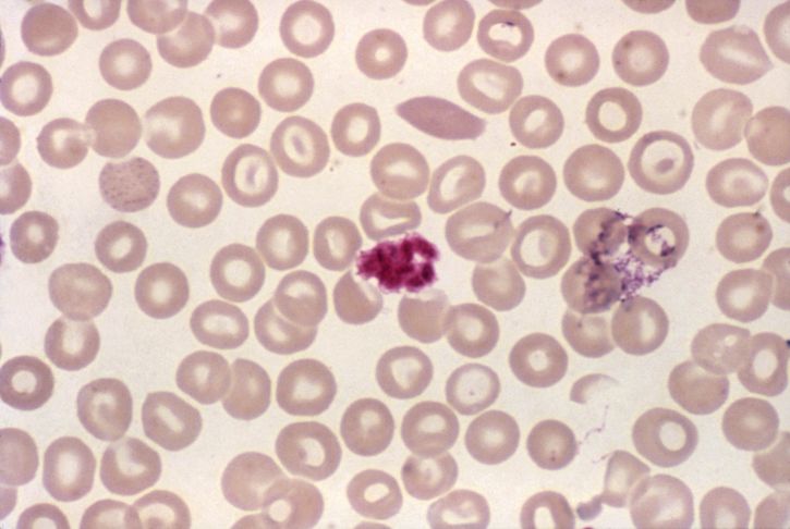 darah smear, mikrograf, rumpun trombosit, menyerupai, malaria, schizont, noda, mag, 1000 x