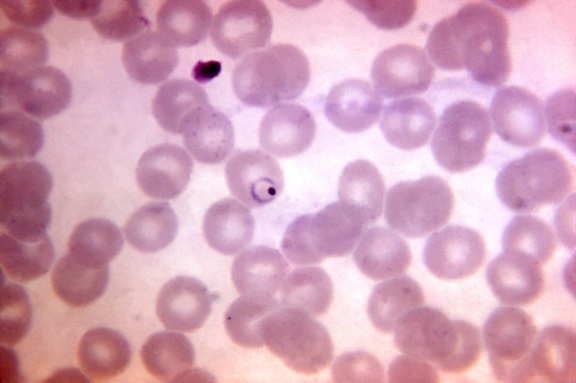 striscio di sangue, al microscopio, la presenza, Plasmodium vivax, l'anello, la forma