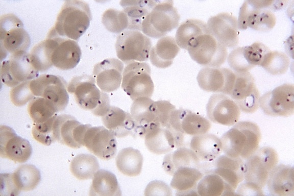 frotis de sangre, micrografía, presencia, numerosas, Plasmodium falciparum, anillos, forma, parásitos, mag, 1150x