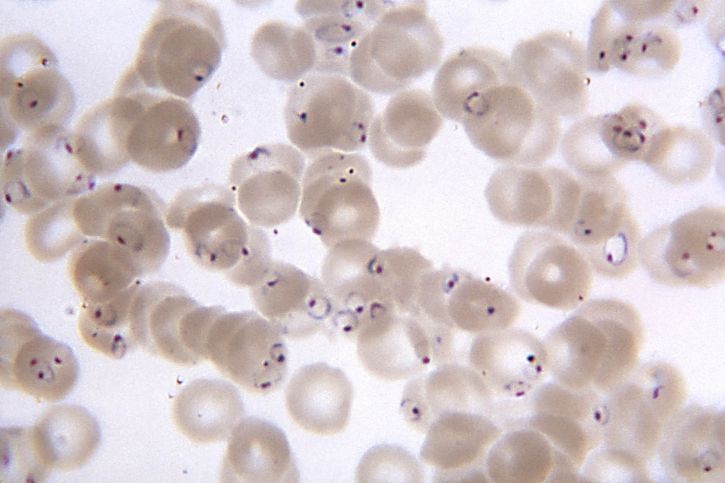 striscio di sangue, al microscopio, la presenza, numerosa, falciparum, anelli, forma, parassiti, MAG, 1150x