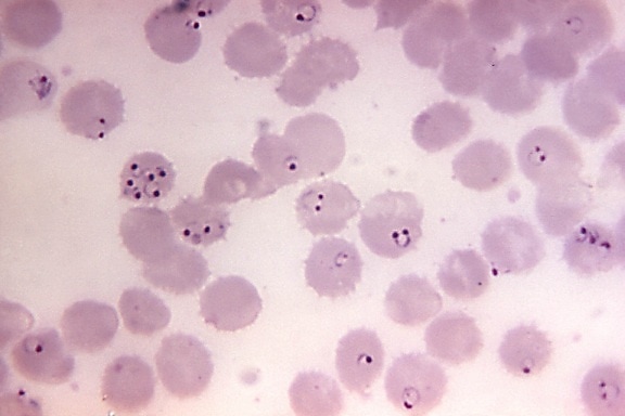 frotis de sangre, micrografía, la presencia, por P. falciparum, anillos, forma, parásitos, mag, 1125x