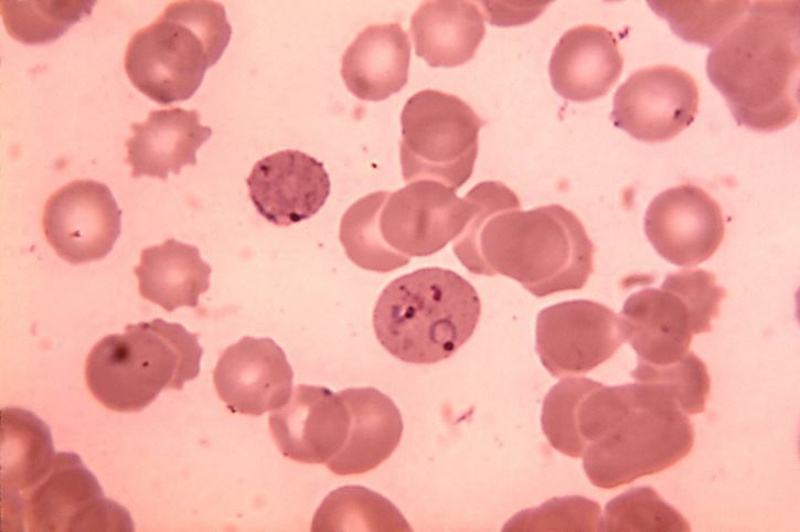 frottis sanguin, micrographie, présence, plasmodium vivax, anneau, scène, parasites