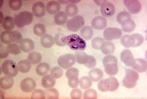 血液涂片, 显微图像, 存在, 不成熟, 间日疟原虫, 裂殖体, mag, 1250x