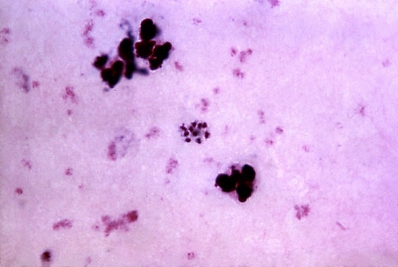 мазок крові, photomicrograph, Зрілі, був описаний malariae, schizont