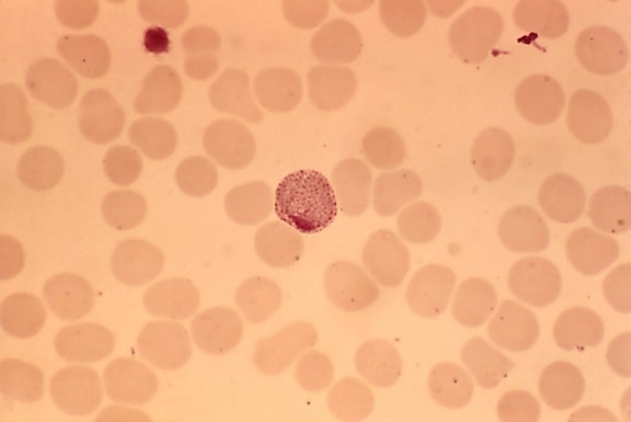 blood smear, photomicrograph, plasmodium vivax, macrogametocyte