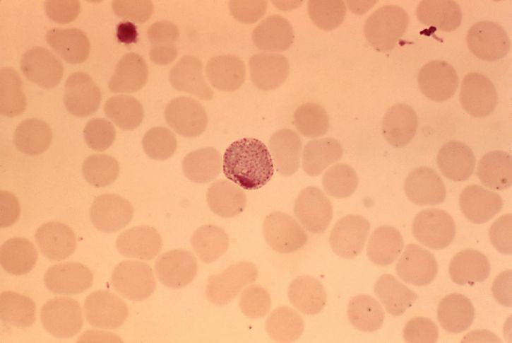frotis de sangre, microfotografía, Plasmodium vivax, macrogametocito