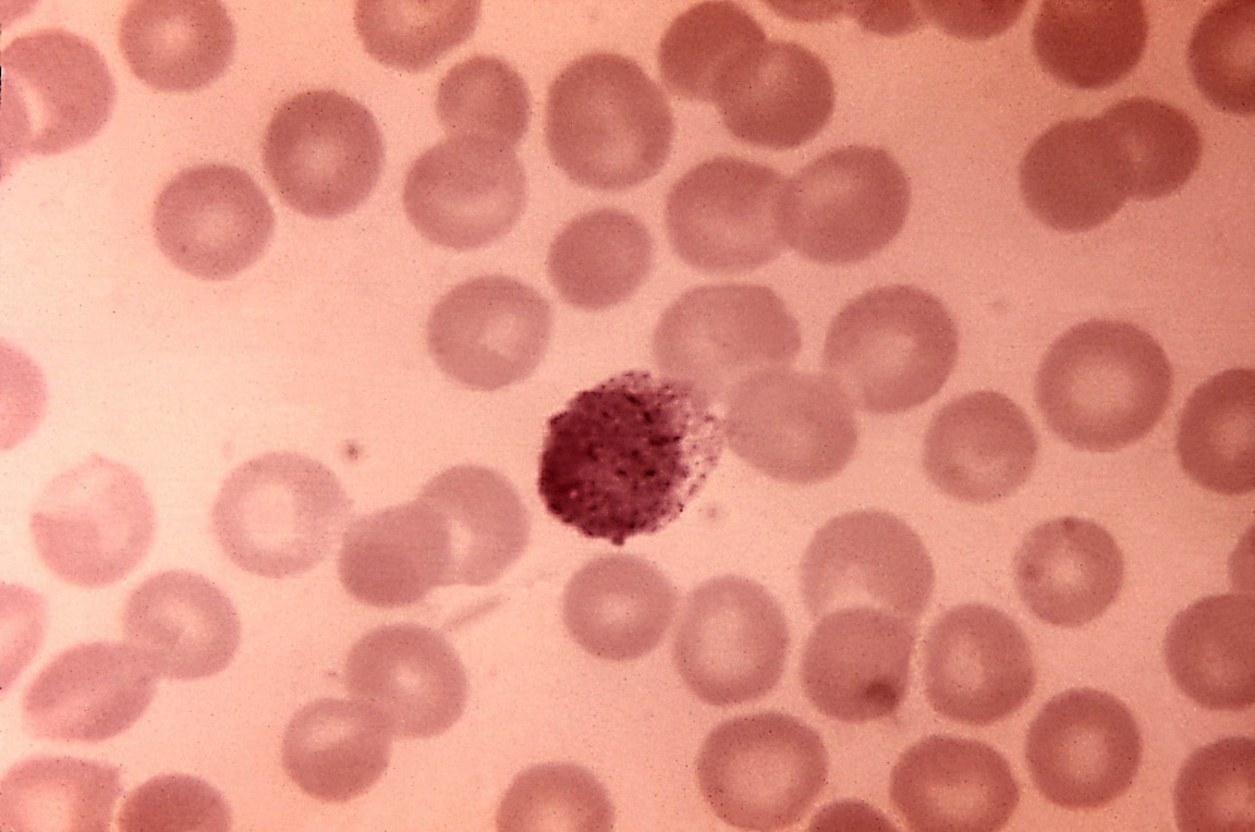 Free Picture Plasmodium Vivax Trophozoite Blood Smea