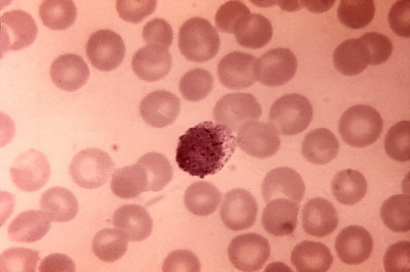 blood smear, photomicrograph, plasmodium vivax, microgametocyte