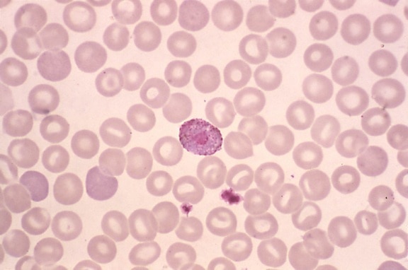 Blutausstrich, Mikrophotographie, Plasmodium vivax, microgametocyte, mag, 1000x