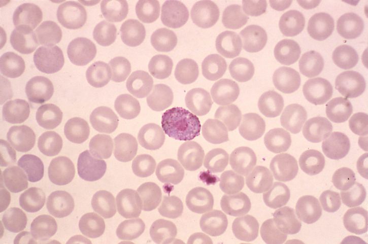 bloed-uitstrijkje, gekleurd, plasmodium vivax, microgametocyte, mag, 1000 x
