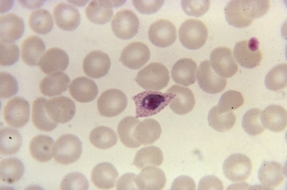frotis de sangre, microfotografía, cada vez mayor, Plasmodium ovale, trophozoite, fimbriated, ovalada