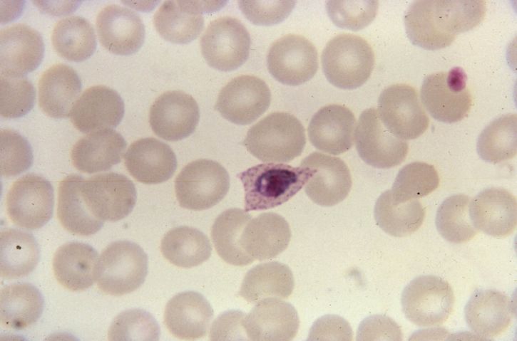 blood smear, photomicrograph, growing, plasmodium ovale, trophozoite, fimbriated, oval
