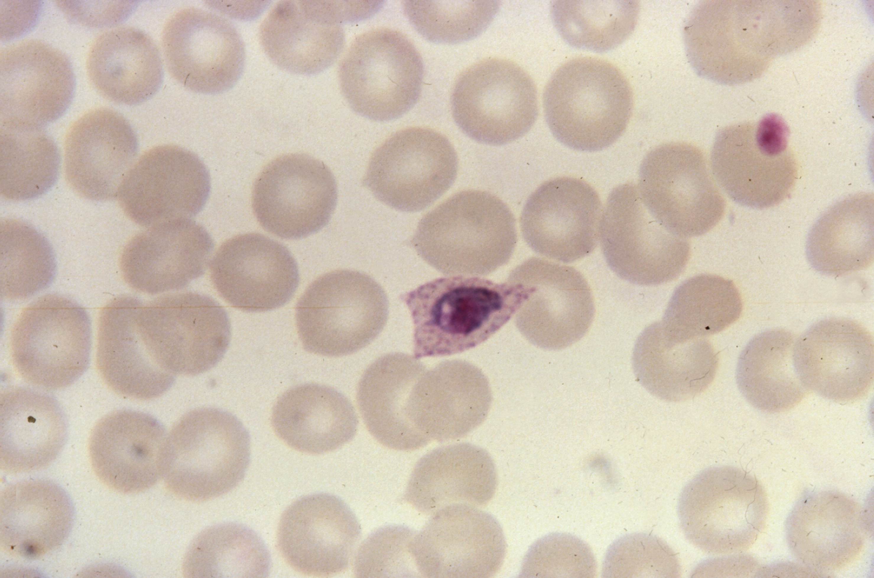 Free picture: blood smear, photomicrograph, growing, plasmodium ovale, trophozoite ...2958 x 1956