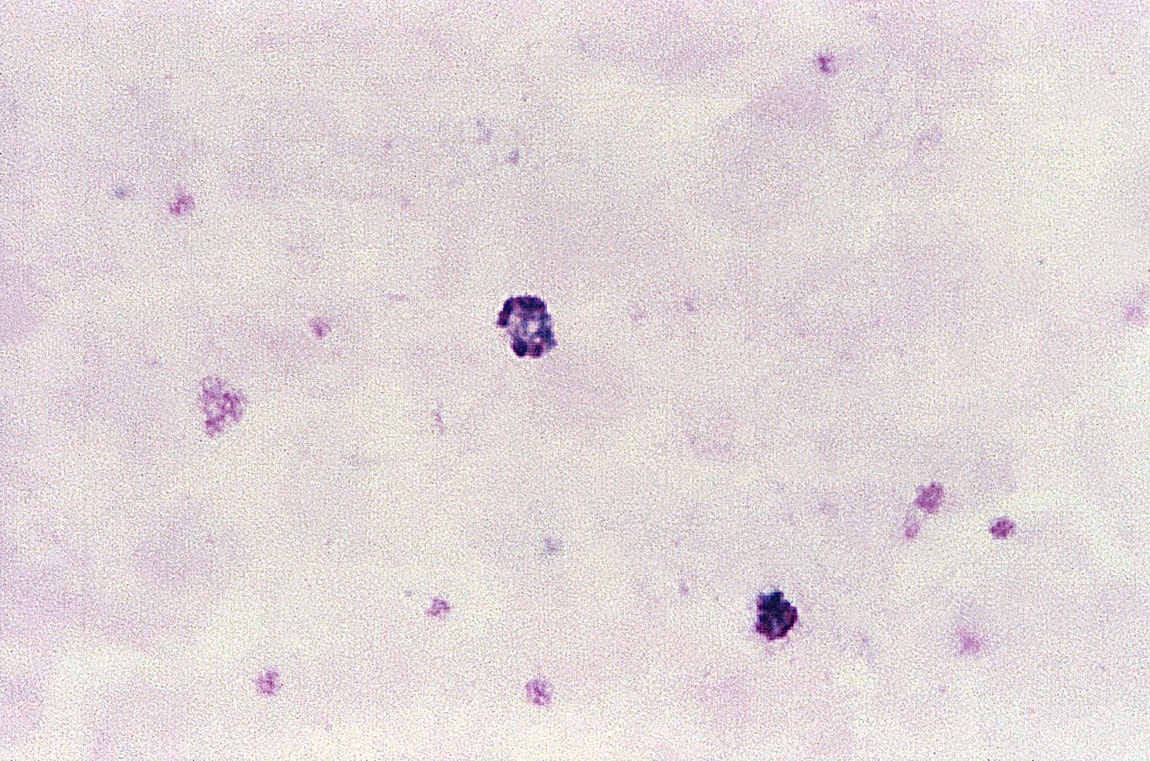 Free Picture: Thin, Film, Micrograph, Plasmodium Vivax, Ring, Form ...