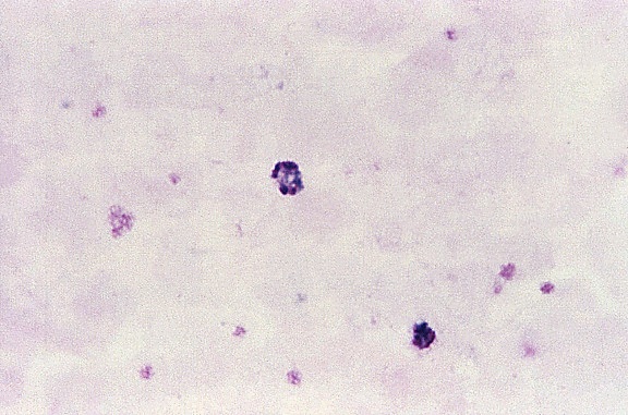 tykk, film, mikroskop-bilde, umodne, malariae, schizont, fire, chromatin, massene