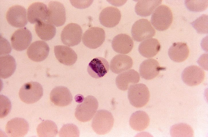 tipis, film, darah smear, mikrograf, band, bentuk, plasmodium malariae, trophozoite