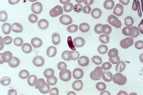 Imagen Gratis Frotis De Sangre Microfotograf A Madura Plasmodium Malariae Esquizontes