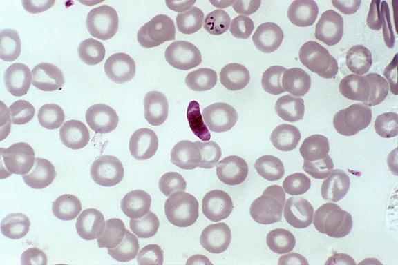 micrographie, frottis de sang, microgamétocyte, parasite, Plasmodium falciparum