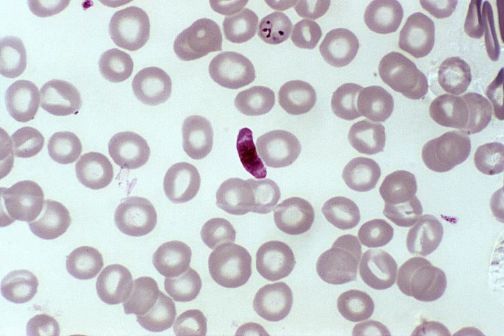 Mikrograf, blod smeta, microgametocyte, parasit Plasmodiumfalciparum