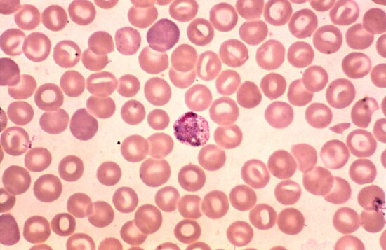 Free picture: blood smear, contains, macro, microgametocyte, plasmodium ...