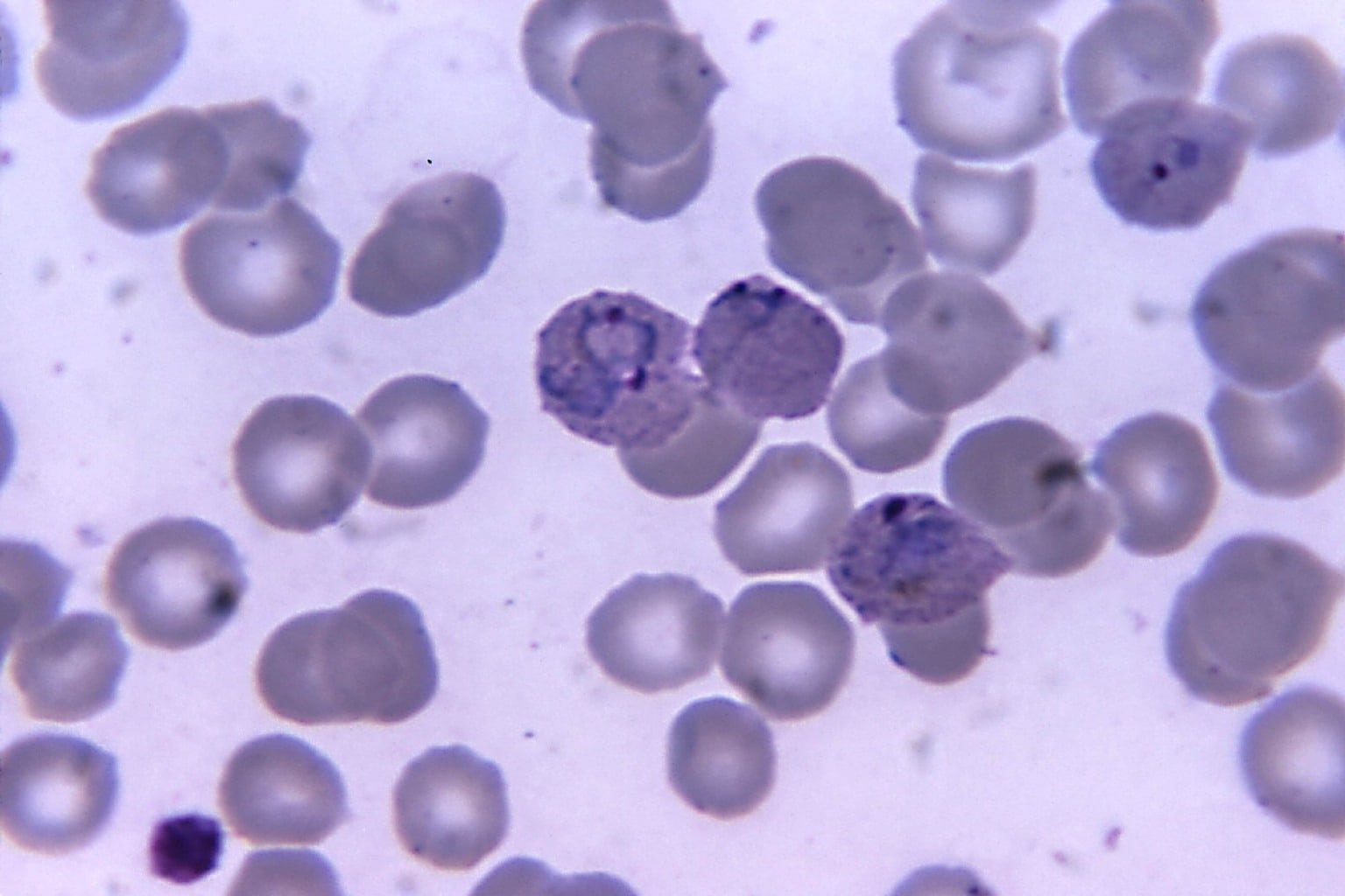 Free Picture Micrograph Cells Malaria Vivax Trophozoites