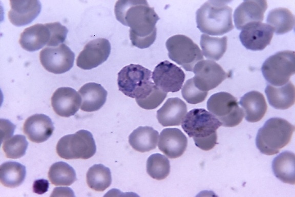 microfotografia, cellule, la malaria, vivax, trofozoiti