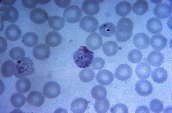 micrographie, film mince, mature, plasmodium vivax, trophozoïte, centre, grossie, 1125x