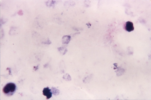 mikroskopische Aufnahme, ovale, zeigt, wachsen, Trophozoiten, unregelmäßig, Zytoplasma, offensichtlich, Pigmentierung, Punktierung