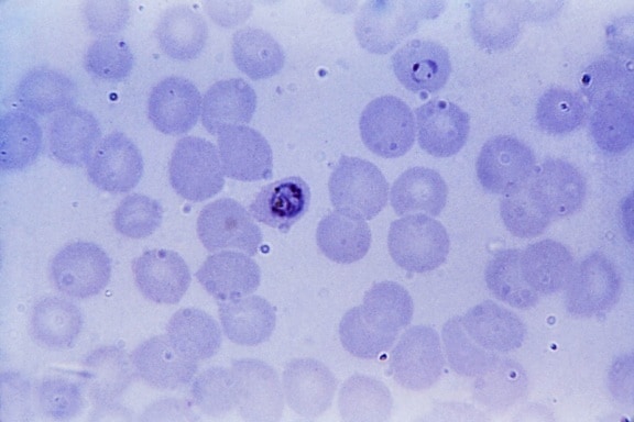 현미경 사진, 변형 체 falciparum, schizont, 셀, 현미경