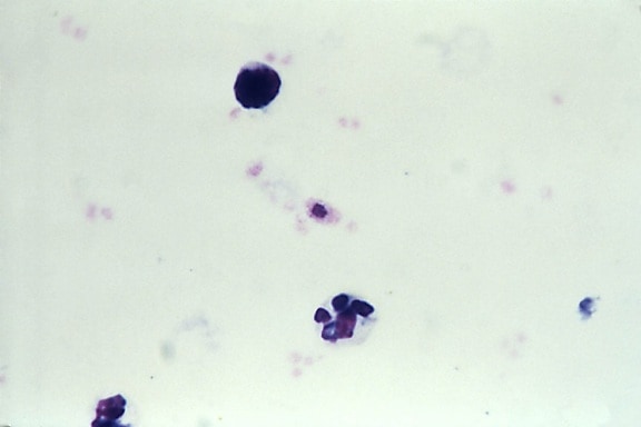 Mikrograf, artefakt, liknar, Plasmodiumfalciparum, gametocyte