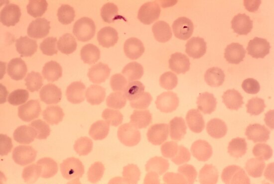 Imagen Gratis Frotis De Sangre Contiene Microgametocito Par Sito Plasmodium Falciparum