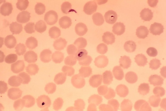 mikroskop-bilde, økende, plasmodium falciparum, trophozoite, ring, form, parasitt