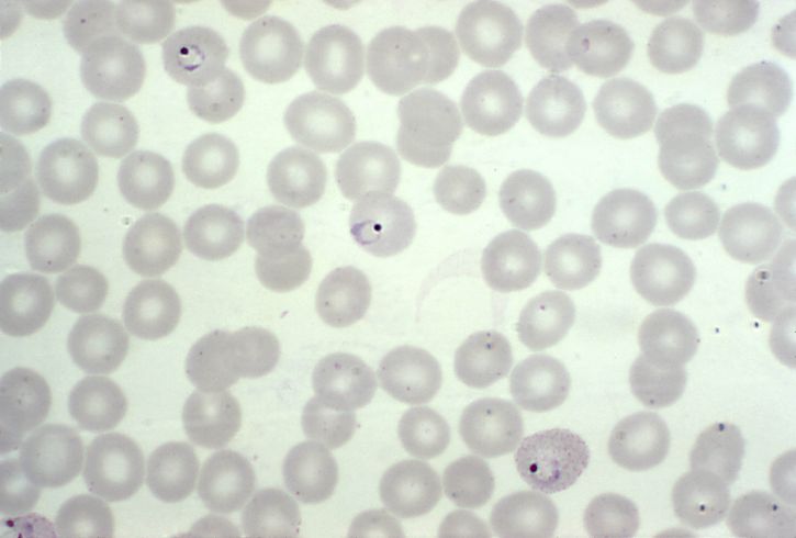 mikrograf, kehadiran, tiga, vivax, cincin, bentuk, parasit, infeksi, host, sel darah merah, mag, 1000 x