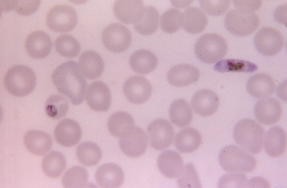 บอร์ด แสดง falciparum macrogametocyte เติบโต malariae, trophozoite