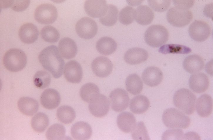 micrograph, cho thấy, falciparum macrogametocyte, phát triển, malariae, trophozoite