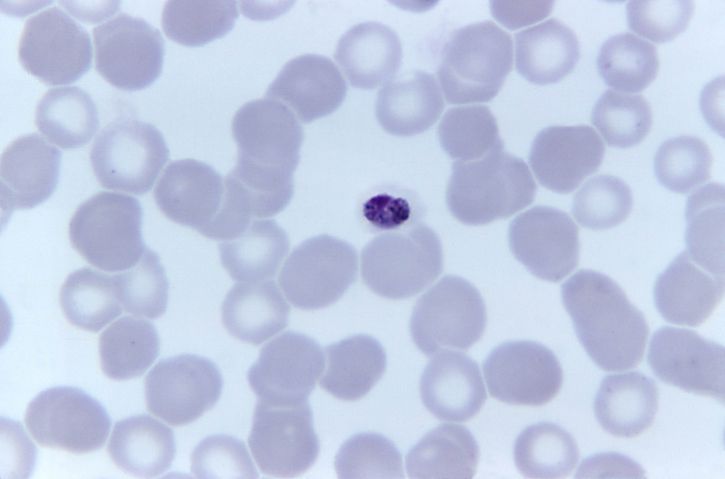 microphotographie, compact, plasmodium malariae, trophozoïte, tache, grossie, 1125x