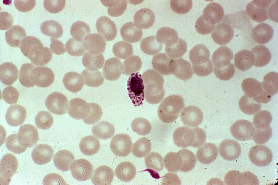 Free Picture: Photomicrograph, Shows, Mature, Plasmodium Malariae ...