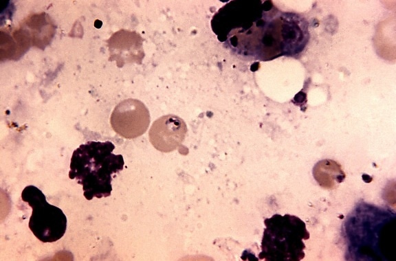 photomicrograph ตับ เนื้อเยื่อ ชันสูตรศพ malariae น้ำมัน แช่ เทคนิค ขยาย 1125 x
